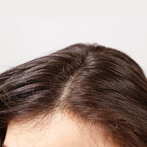 روش‌های مراقبت از موهای خشک