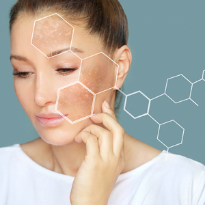 لک پوستی چیست و چه درمانی دارد؟