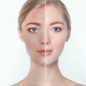 لایه برداری پوست صورت سلول های خشک و مرده پوست و سایر مواد (مانند آرایش) را از صورت شما پاک می کند. این به باز کردن منافذ، کاهش آکنه و یکنواخت شدن رنگ پوست کمک می کند.
